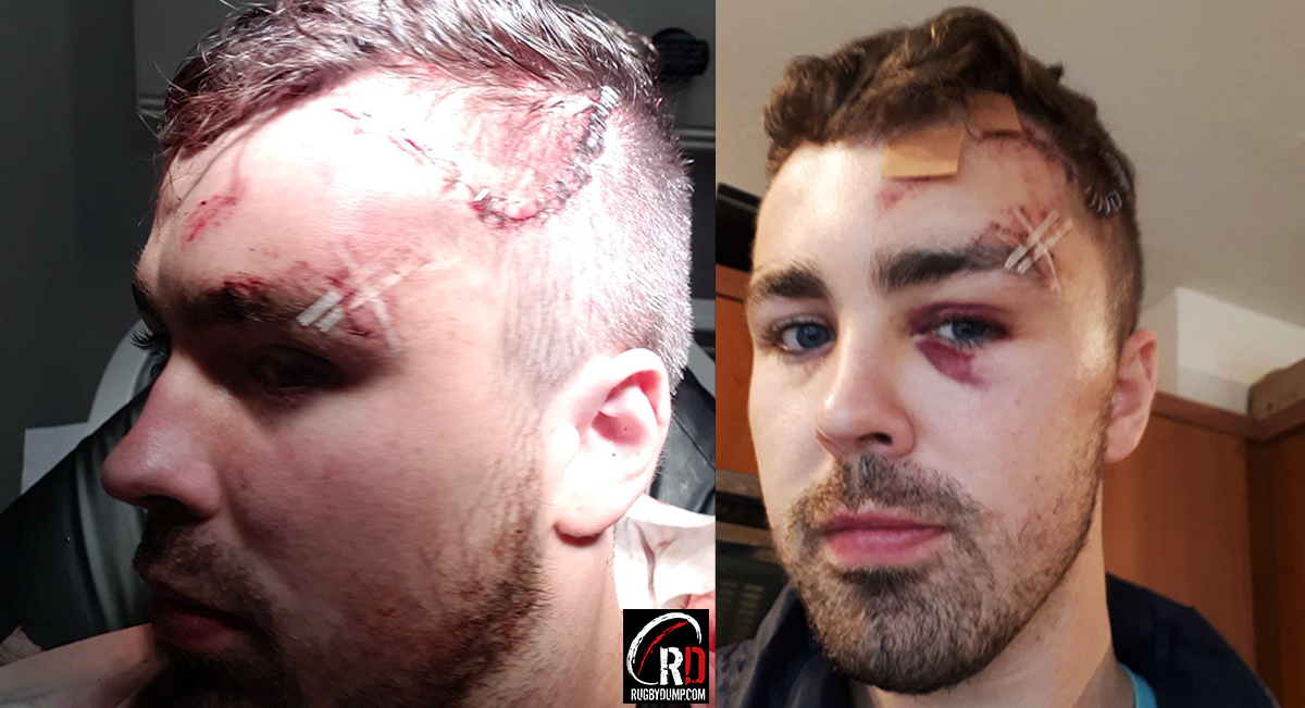 Kyle Hetherinton head injury after