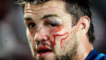 Owen Franks hit and head-clash with Flip Van Der Merwe