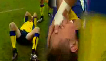 Marius Joubert play acting after a tap on the head